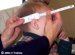 Child's head circumference being measured