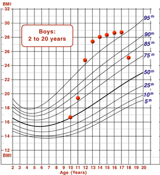 Chart showing Don's BMI rising rapidly between 11-13 years of age, then rising gradually thereafter before falling dramatically between 17-18 years of age.
